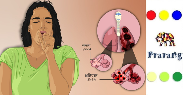 मेरठ में बढ़ता प्रदूषण और बदलती जीवनशैली: फेफड़ों के लिए सी ओ पी डी का खतरा